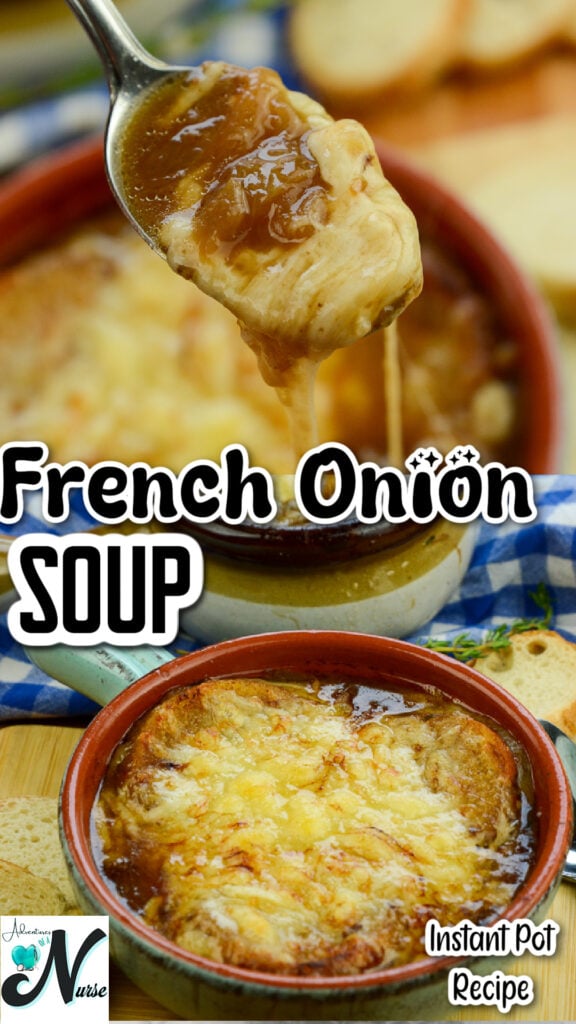 Instant Pot French Onion Soup Pin